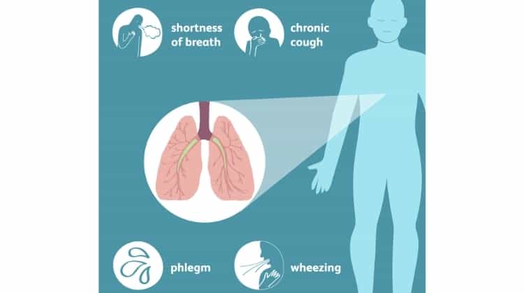 COPD Progression